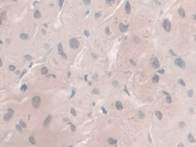 HFE2 Antibody in Immunohistochemistry (Paraffin) (IHC (P))