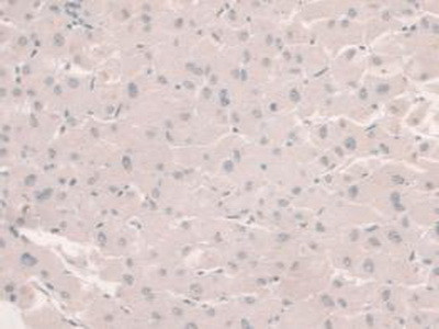 HFE2 Antibody in Immunohistochemistry (Paraffin) (IHC (P))