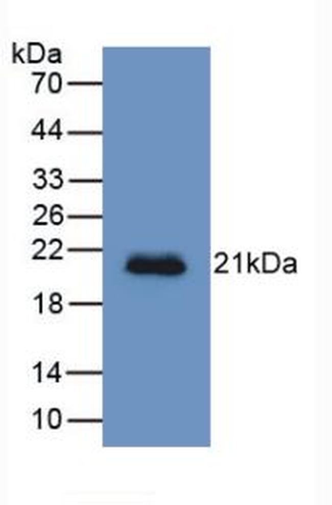 HFE2 Antibody in Western Blot (WB)