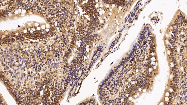 HDAC1 Antibody in Immunohistochemistry (Paraffin) (IHC (P))