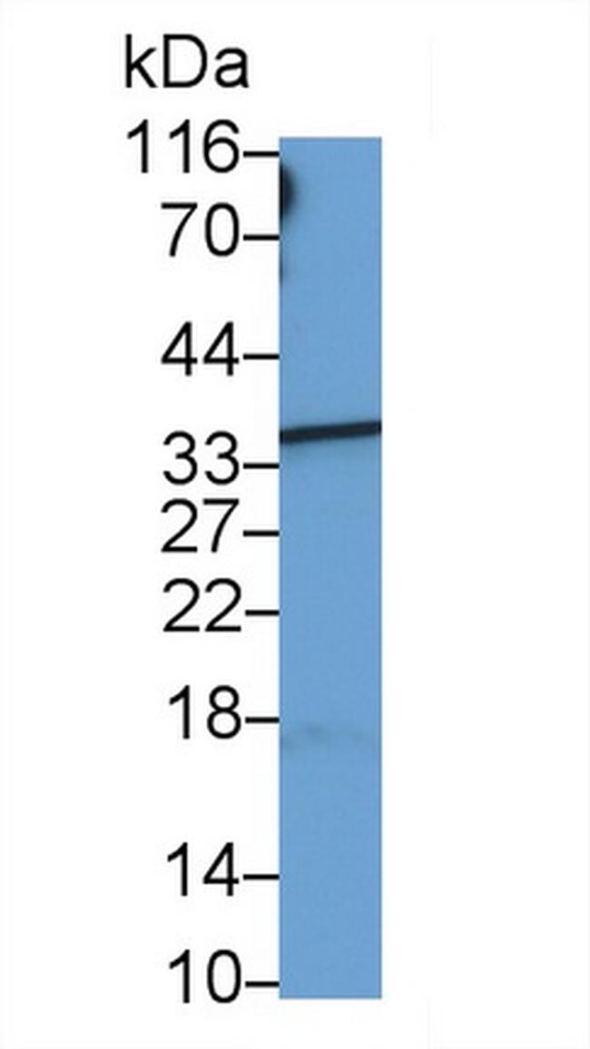 HBB Antibody in Western Blot (WB)