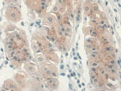 GREM1 Antibody in Immunohistochemistry (Paraffin) (IHC (P))