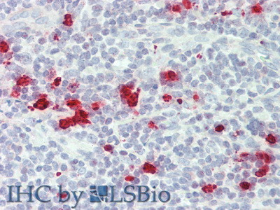 Granzyme M Antibody in Immunohistochemistry (Paraffin) (IHC (P))