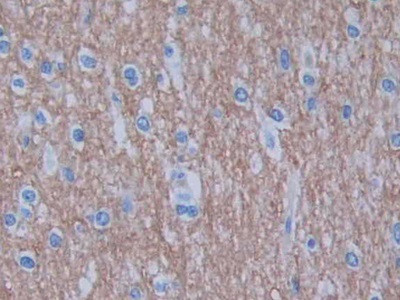 GHRH Antibody in Immunohistochemistry (Paraffin) (IHC (P))