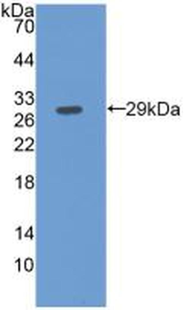 Fibulin 3 Antibody in Western Blot (WB)