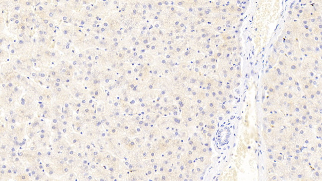 Ferritin Light Chain Antibody in Immunohistochemistry (Paraffin) (IHC (P))