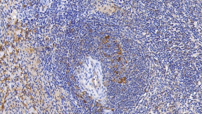 Ferritin Heavy Chain Antibody in Immunohistochemistry (Paraffin) (IHC (P))