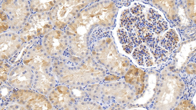 Ferritin Heavy Chain Antibody in Immunohistochemistry (Paraffin) (IHC (P))