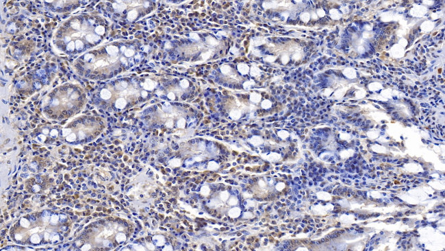 ERLIN2 Antibody in Immunohistochemistry (Paraffin) (IHC (P))