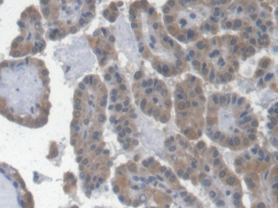 Epo Antibody in Immunohistochemistry (Paraffin) (IHC (P))