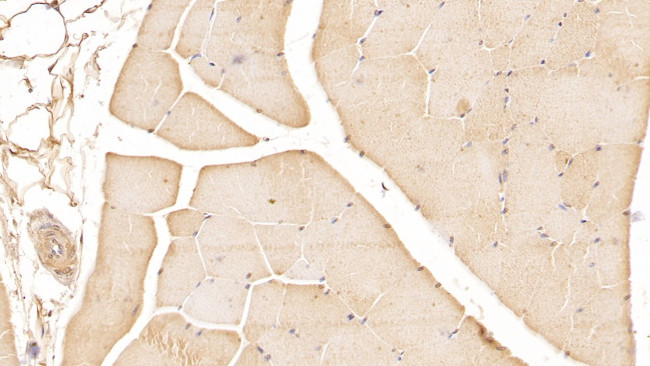 DUSP3 Antibody in Immunohistochemistry (Paraffin) (IHC (P))