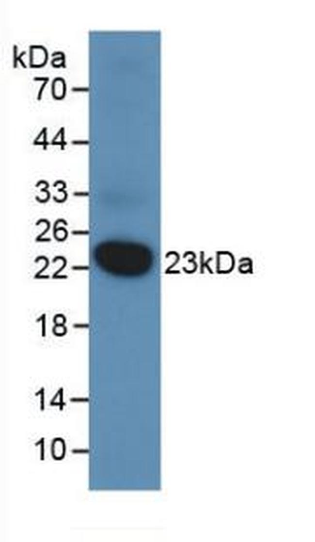 DUSP3 Antibody in Western Blot (WB)