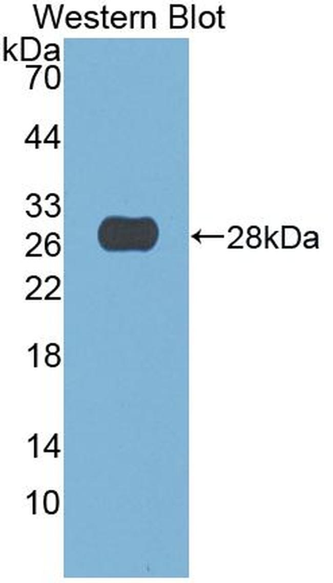 DNASE1 Antibody in Western Blot (WB)