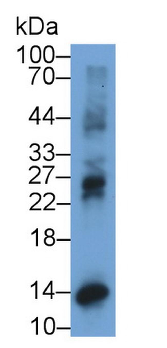 CXCL10 (IP-10) Antibody in Western Blot (WB)