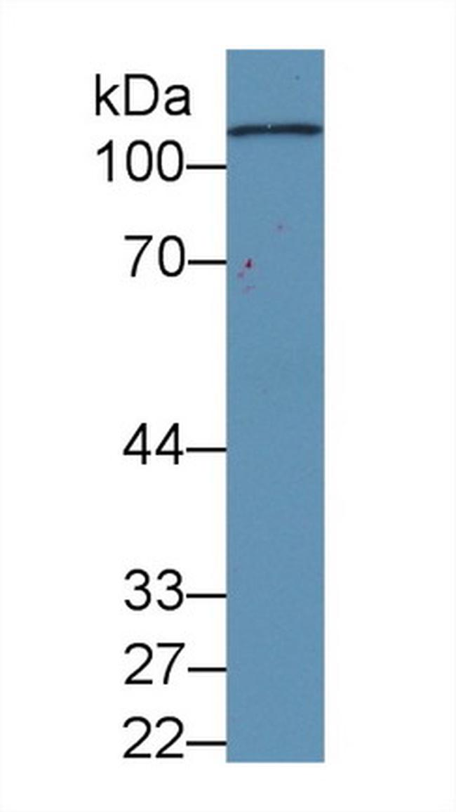 Complement C5a Antibody in Western Blot (WB)