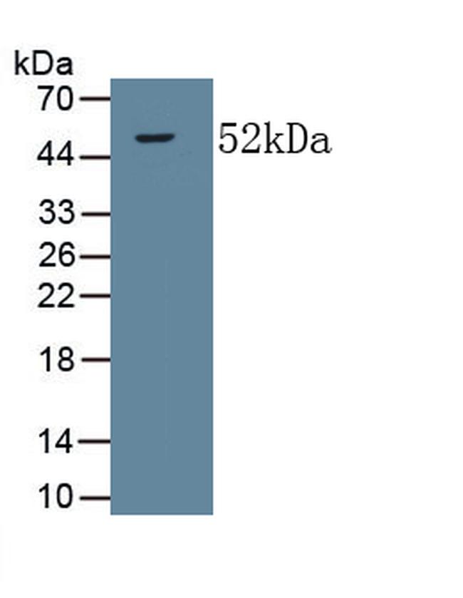 COL5A2 Antibody in Western Blot (WB)