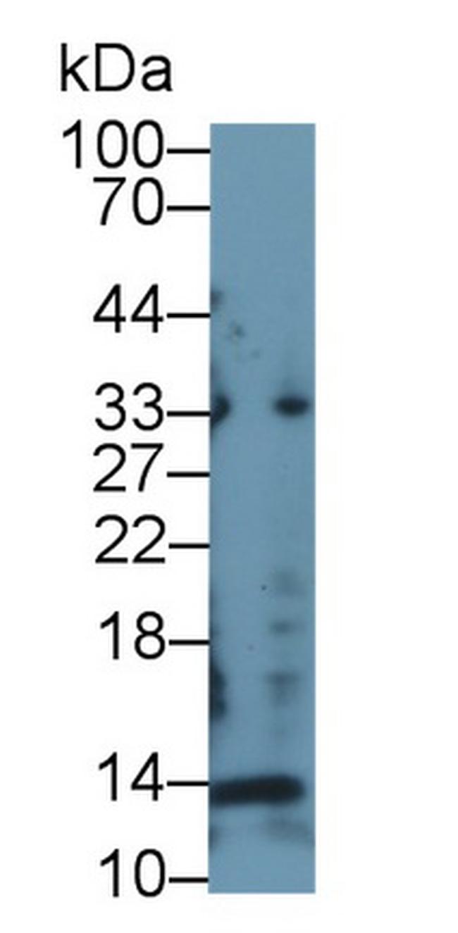 Procollagen I N-Peptide Antibody in Western Blot (WB)