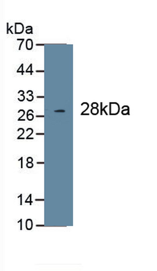 COL1A1 Antibody in Western Blot (WB)