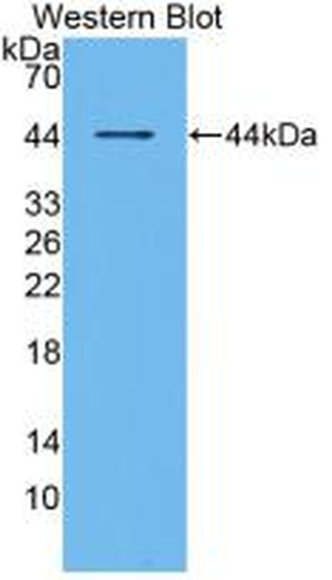 RANK (CD265) Antibody in Western Blot (WB)