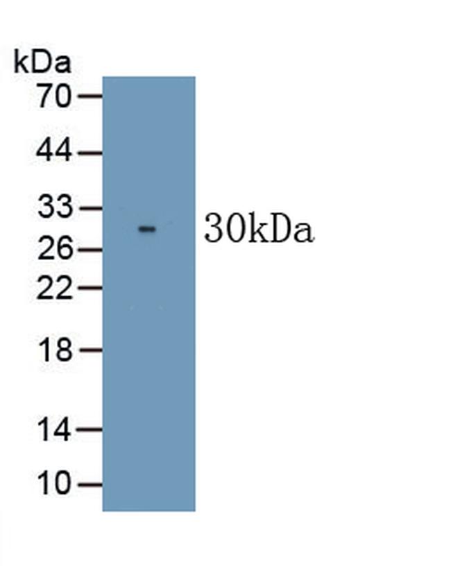 CD226 (DNAM-1) Antibody in Western Blot (WB)