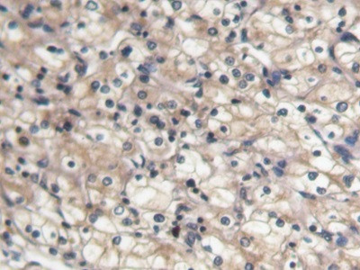 BMP-7 Antibody in Immunohistochemistry (Paraffin) (IHC (P))