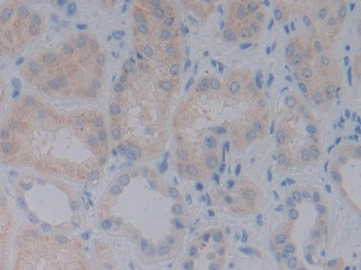 BMP-10 Antibody in Immunohistochemistry (Paraffin) (IHC (P))