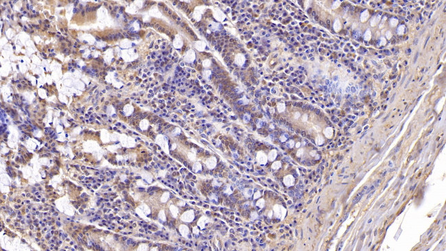 ASPH Antibody in Immunohistochemistry (Paraffin) (IHC (P))