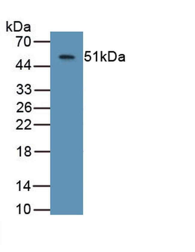 ASPH Antibody in Western Blot (WB)