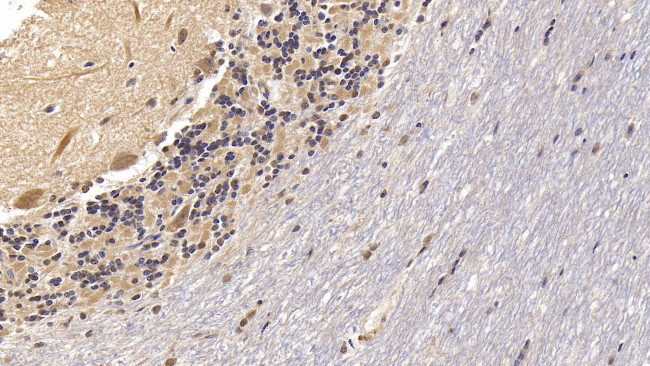 VDAC Antibody in Immunohistochemistry (Paraffin) (IHC (P))