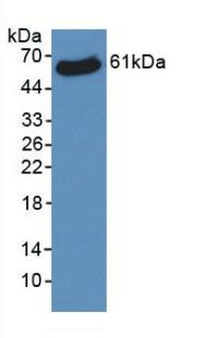 VDAC Antibody in Western Blot (WB)