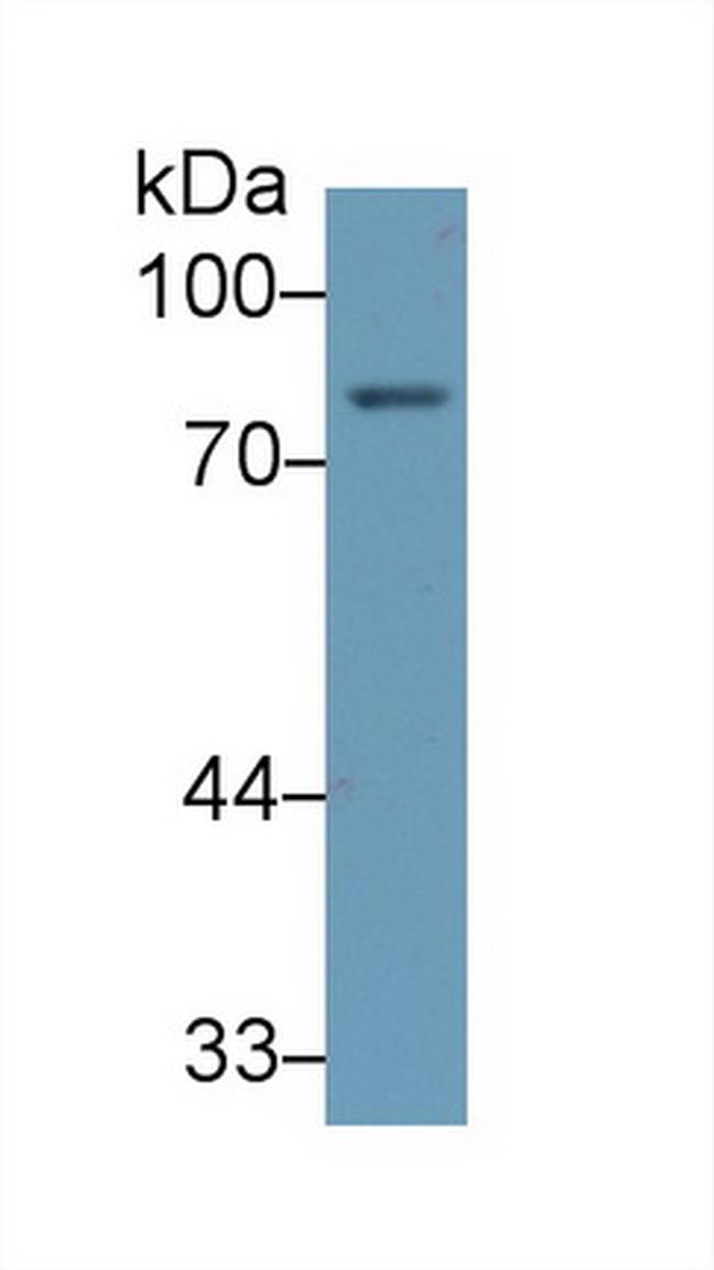 ALOX5 Antibody in Western Blot (WB)