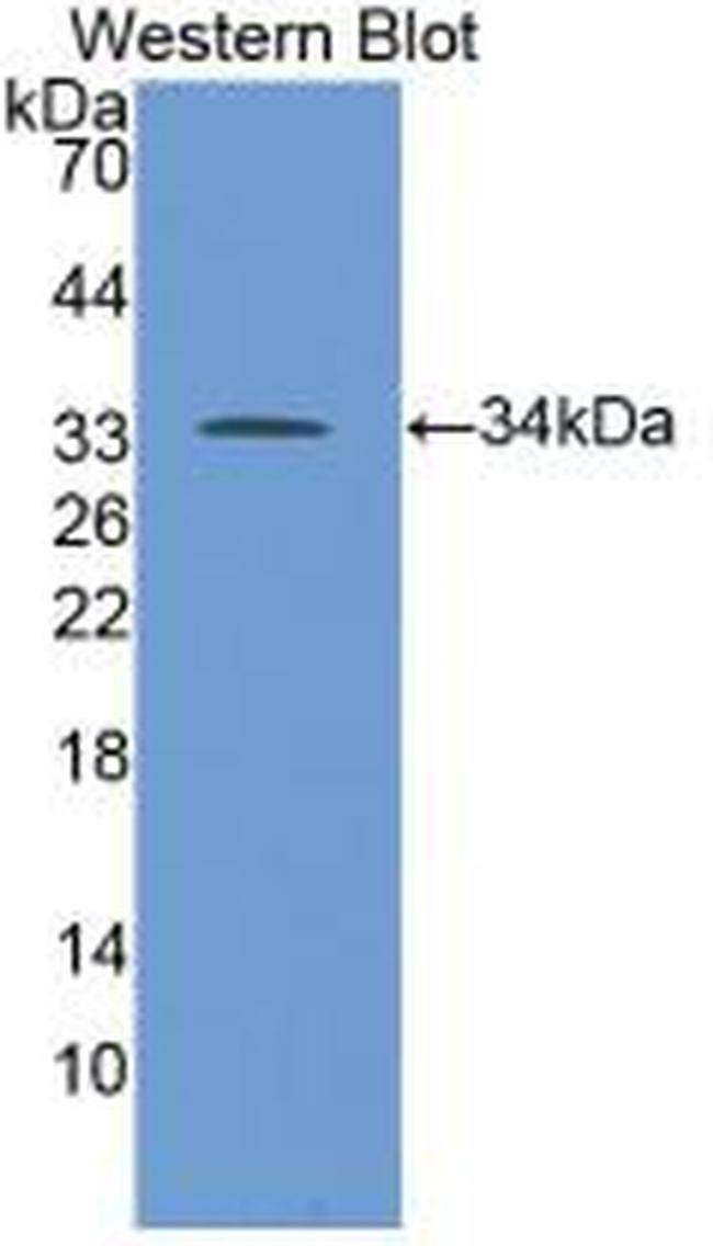 ALOX5 Antibody in Western Blot (WB)