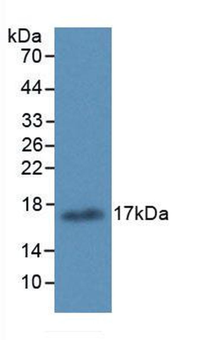 ALOX15 Antibody in Western Blot (WB)