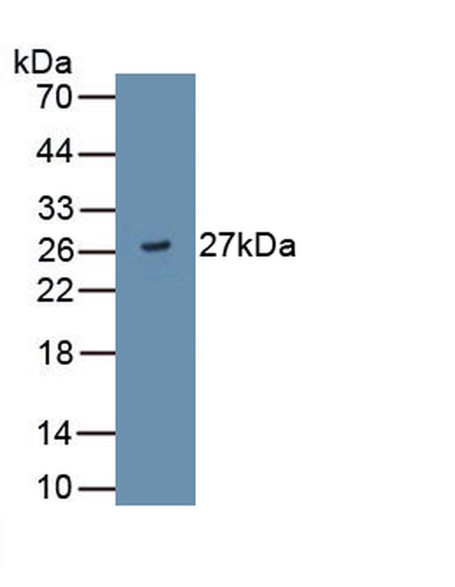 ADAMTS9 Antibody in Western Blot (WB)