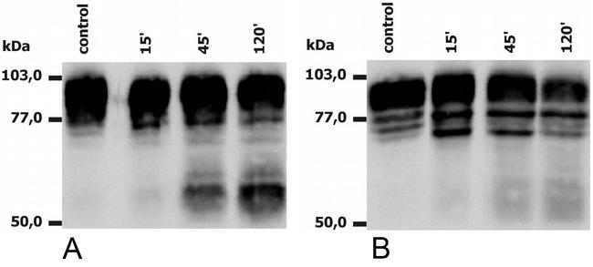 CD18 Antibody in Western Blot (WB)