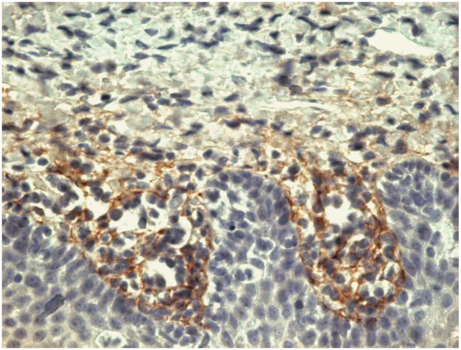 Tenascin C Antibody in Immunohistochemistry (Paraffin) (IHC (P))