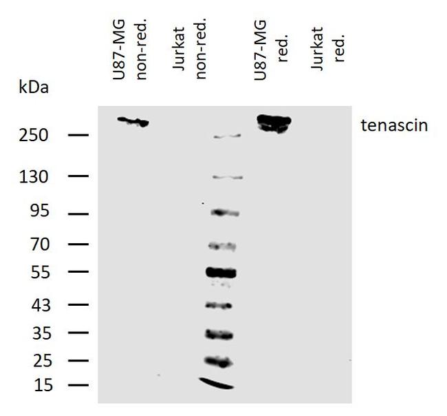 Tenascin C Antibody in Western Blot (WB)