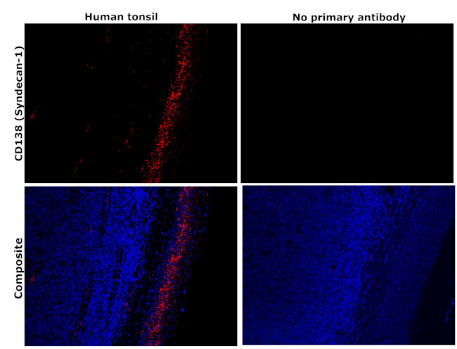 CD138 Antibody in Immunohistochemistry (Paraffin) (IHC (P))