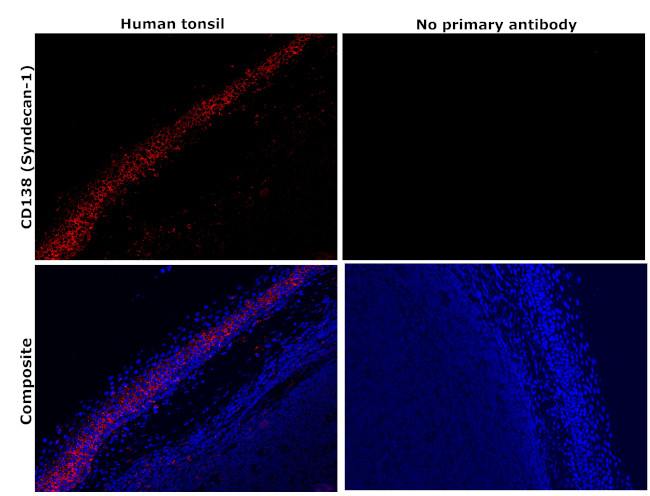 CD138 Antibody in Immunohistochemistry (Paraffin) (IHC (P))