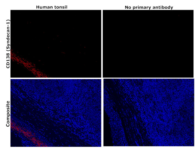 CD138 Antibody in Immunohistochemistry (Paraffin) (IHC (P))