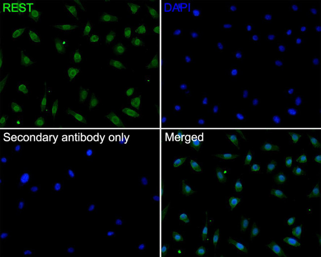 REST Antibody in Immunocytochemistry (ICC/IF)