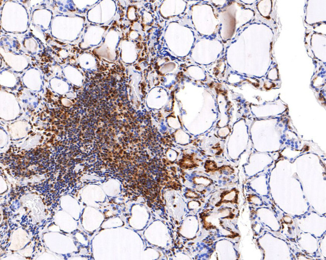 REST Antibody in Immunohistochemistry (Paraffin) (IHC (P))