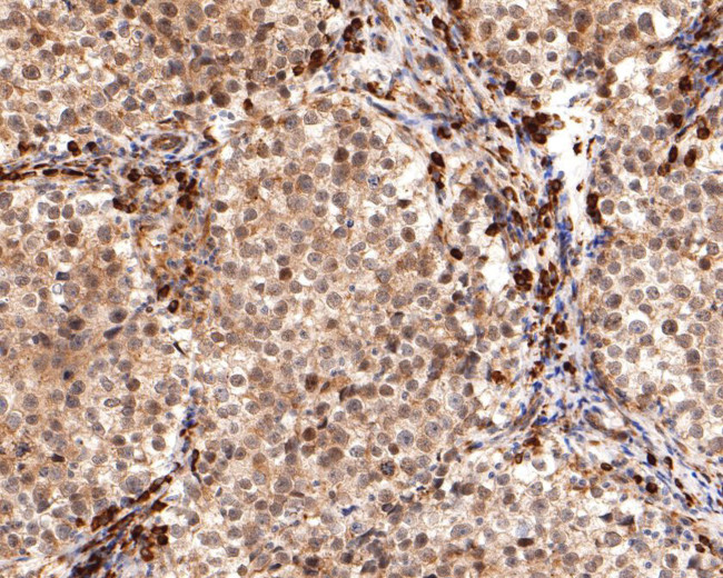 REST Antibody in Immunohistochemistry (Paraffin) (IHC (P))