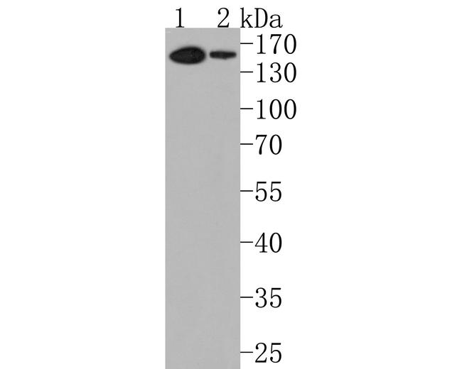 REST Antibody in Western Blot (WB)