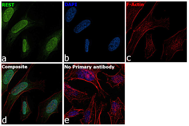 REST Antibody in Immunocytochemistry (ICC/IF)