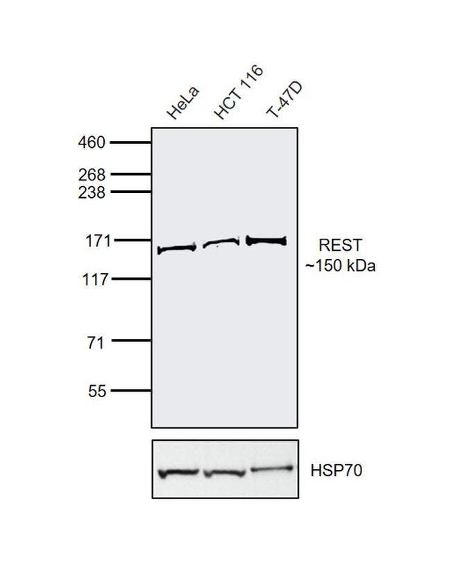 REST Antibody in Western Blot (WB)