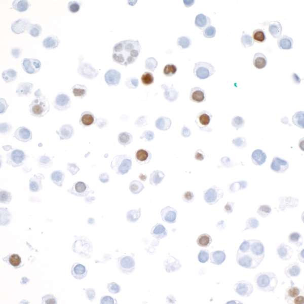 V5 Tag Antibody in Immunocytochemistry (ICC/IF)