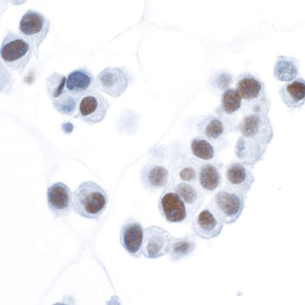 HIF-1 alpha Antibody in Immunocytochemistry (ICC/IF)