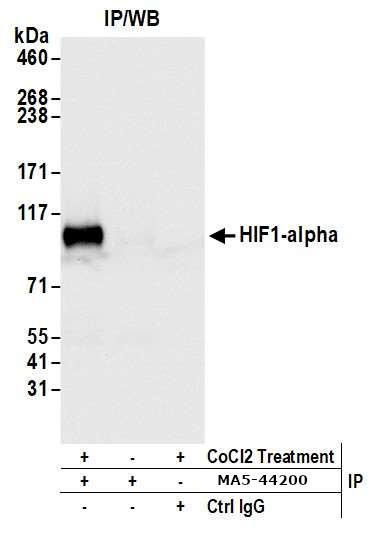 HIF-1 alpha Antibody in Immunoprecipitation (IP)