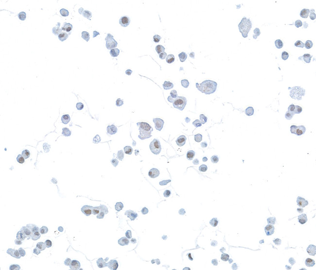 HIF-2 alpha Antibody in Immunocytochemistry (ICC/IF)